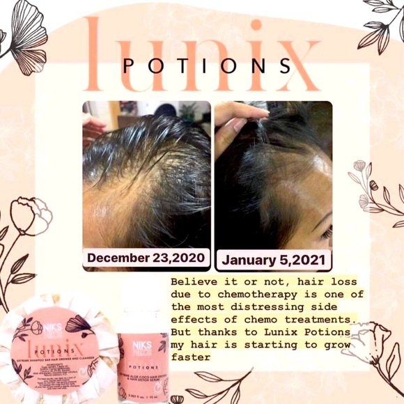 Other - Hair Growth Treatment